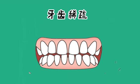北京面相 通过牙齿稀疏来看个人命运 北京面相 通过牙齿稀疏来看个人命运