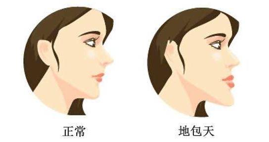女性有地包天感情运势如何? 女性有地包天感情运势如何?