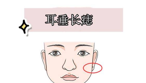 男人耳垂长痣性格好 男人耳垂长痣性格好
