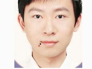 男人哪里长痣最旺妻? 男人哪里长痣最旺妻?