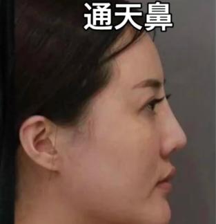 不同性别的通天鼻有怎样的差异? 不同性别的通天鼻有怎样的差异?