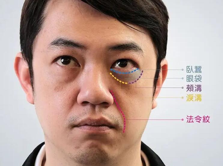 眼袋区域干瘪代表了什么? 眼袋区域干瘪代表了什么?