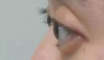 金鱼眼面相好不好? 金鱼眼面相好不好?