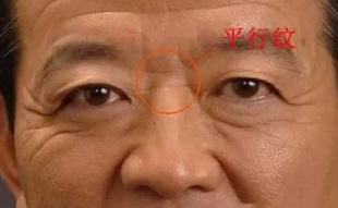 平行纹 平行纹