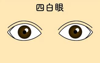 四白眼是什么 四白眼是什么