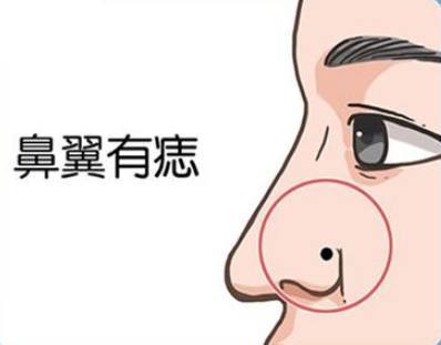 鼻子上长痣好不好