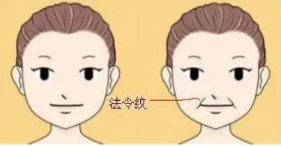 没有法令纹的女人面相好吗