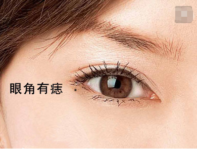 女人哪些地方有痣不好