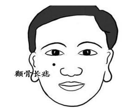 大师告诉你哪些痣象征男性事业有成