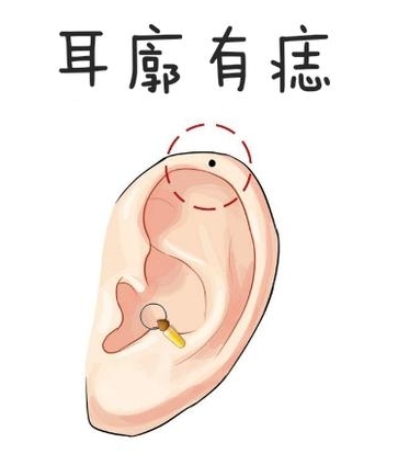 耳垂有痣的女人好不好