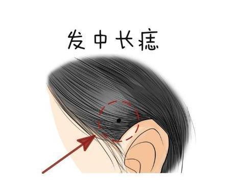 女人聚财痣长在哪里? 女人聚财痣长在哪里?