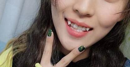 算命大师秦阳明:有虎牙的女人命怎么样?