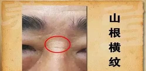 面相大师告诉你鼻梁上有横纹的面相好吗