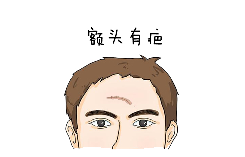 身上的疤痕会不会影响人的运势?