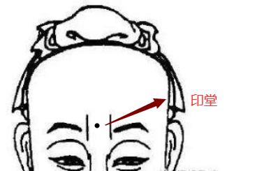 印堂发黑代表什么意思呢?