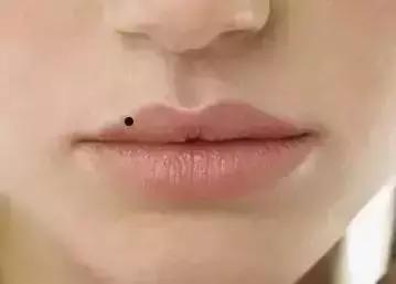 女人脸上的哪些痣需要点掉?