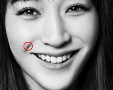 女人脸上的哪些痣需要点掉?