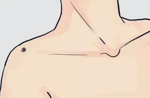 风水大师解读左肩膀有痣的男人运势