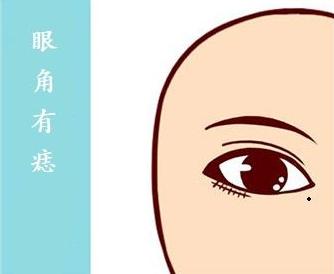问:内眼角长痣的面相好吗?