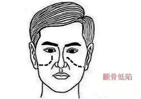 面色铁青面相的男人不要嫁