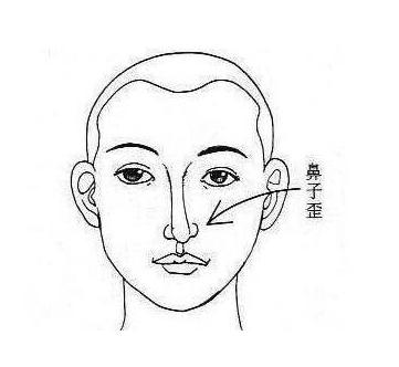 鼻子歪鼻梁的人好不好?