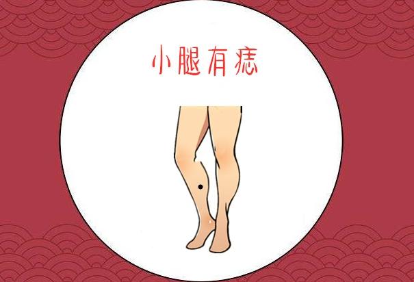 痣相分析腿上有痣代表什么