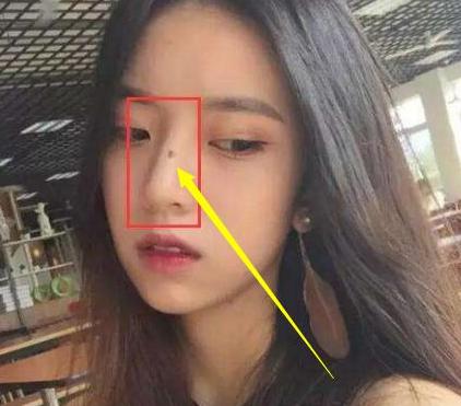 鼻梁上有痣:聚财痣
