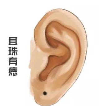 耳珠有痣叫聚财痣