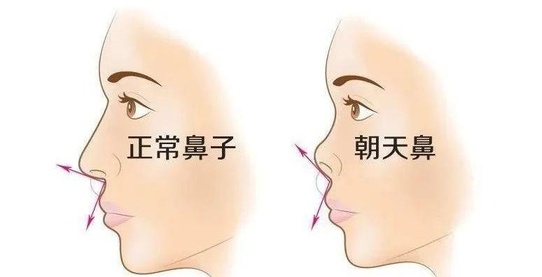 天津面相大师秦阳明分析露鼻孔的人财运如何?