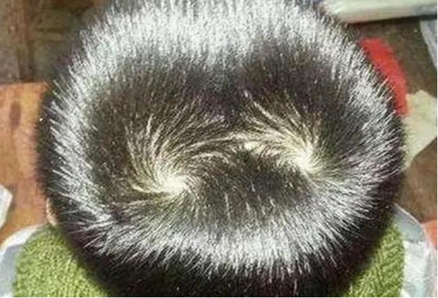 有牛头旋的人命运如何