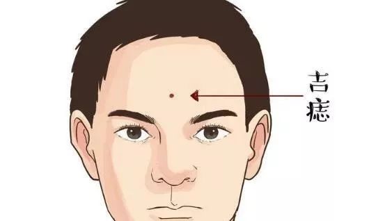 天津看相:男人身上哪些是好痣、哪些是恶痣?