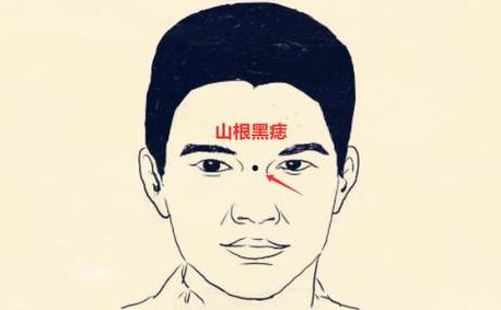 天津看相:男人身上哪些是好痣、哪些是恶痣?