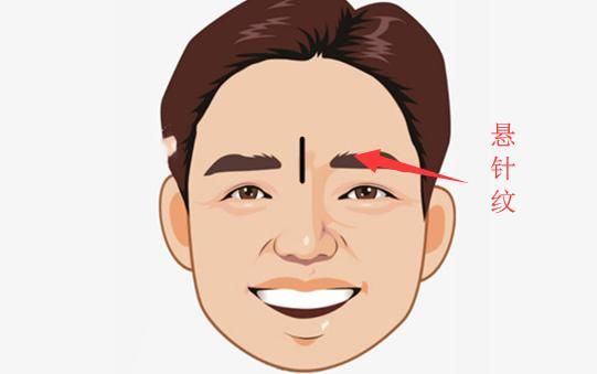 印堂有痣的含义 印堂有痣的含义